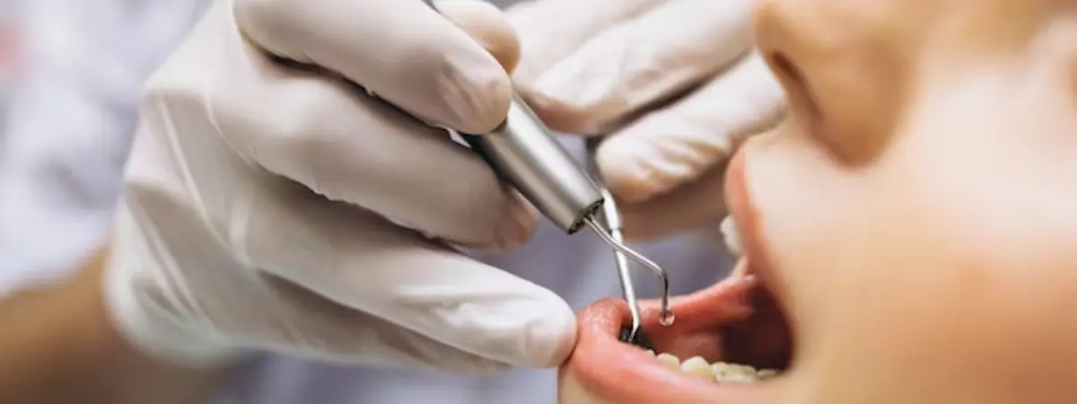 Exploring the Enigma: The Rarest Dental Disease Unveiled