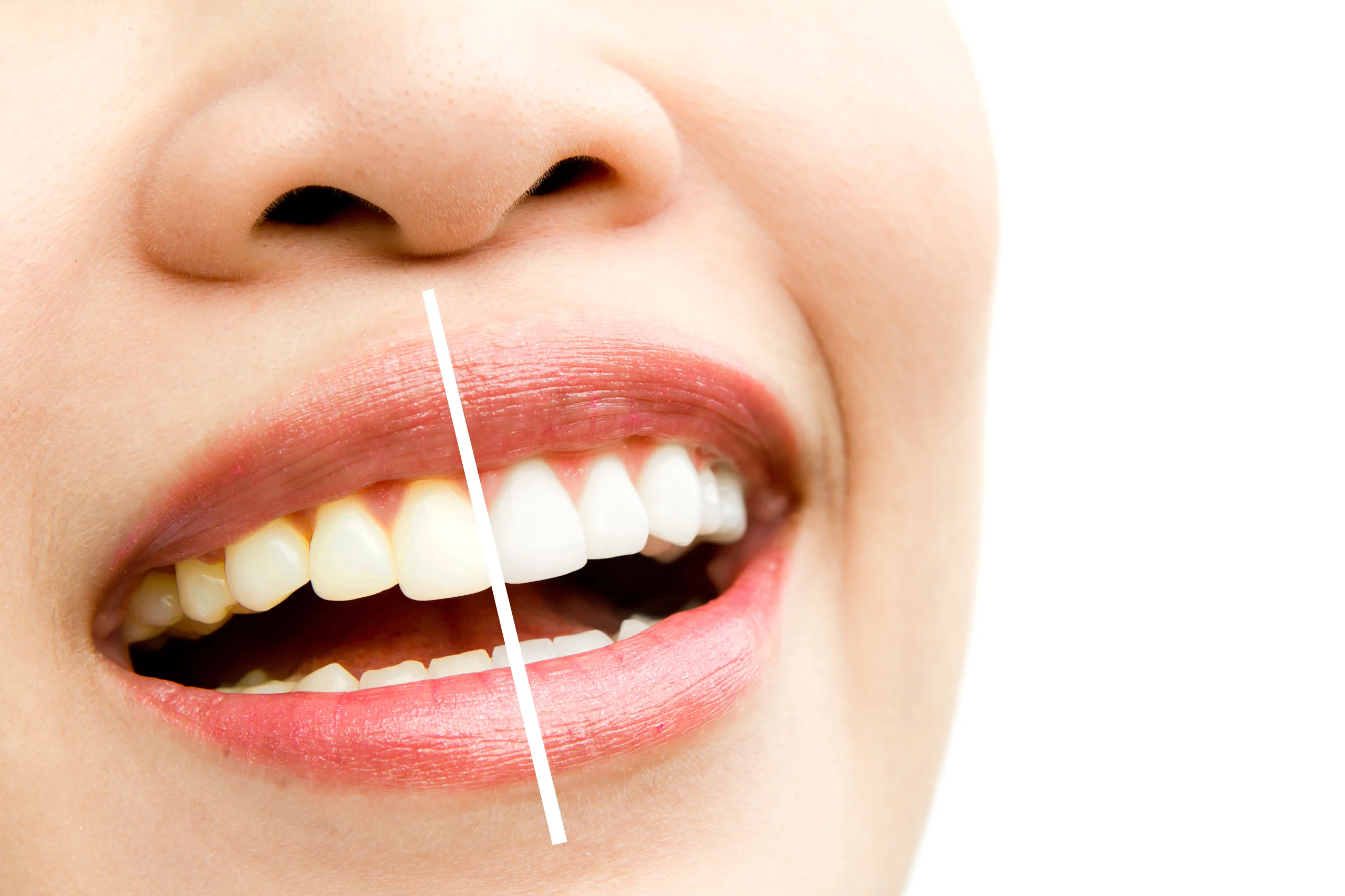 Smile Bright: The Benefits of Teeth Whitening and Cosmetic Dentistry at Williamstown Road Dental Surgery